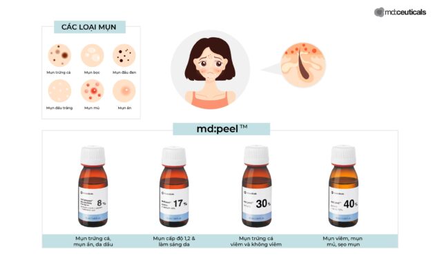 md:peel với các sản phẩm thay da sinh học phù hợp với từng tình trạng mụn, chứa nồng độ khác nhau từ nhẹ đến cao